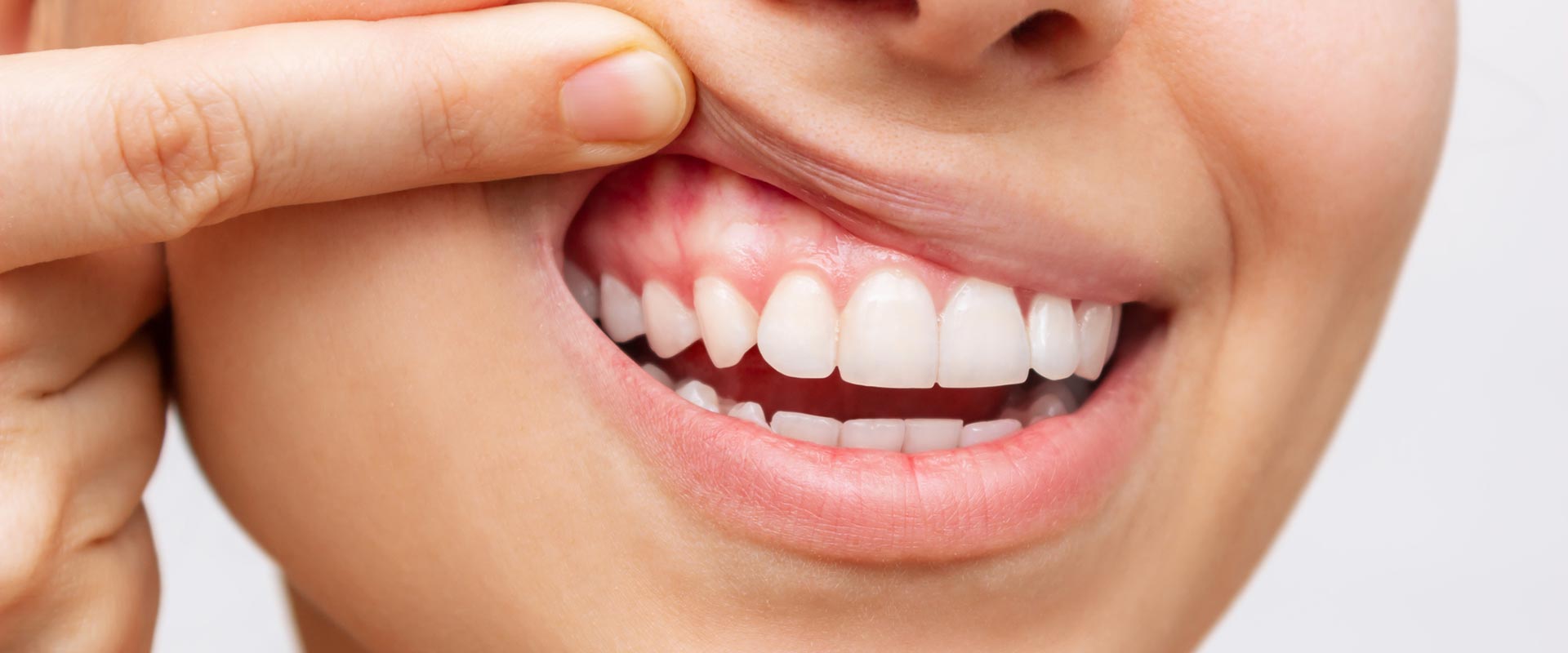 Gum-Periodontal-Health