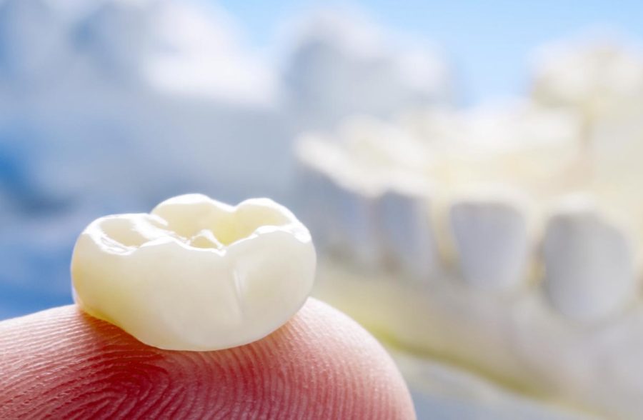 crowns-bridges-dentist